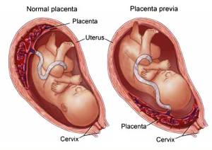 cervix after pregnancy